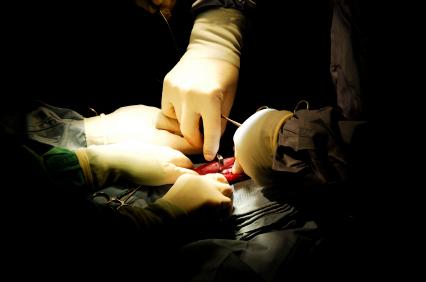 Do you know why they call it back surgery? Because you’ll keep coming back!