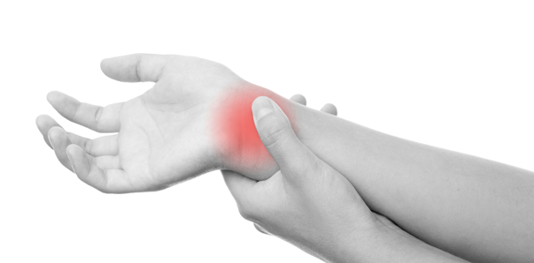 Carpal Tunnel Syndrome
