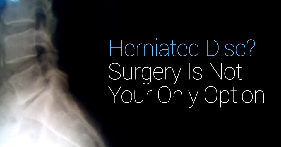 Herniated Disc? Surgery Is Not Your Only Option
