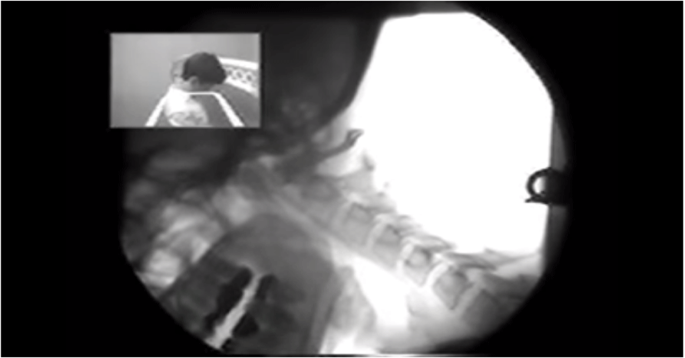 How the Digital Motion Xray Can Diagnose Soft Tissue Injuries