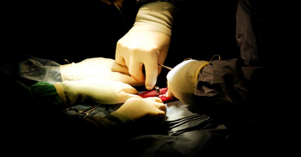 Is PTSD directly related to fusion surgery for back pain patients