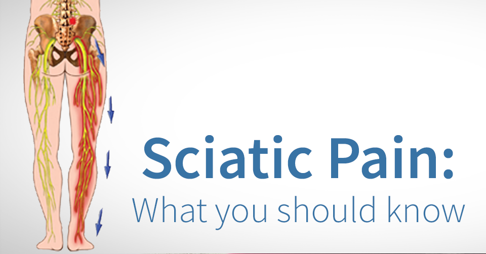 Sciatic Nerve Pain Causes and Relief