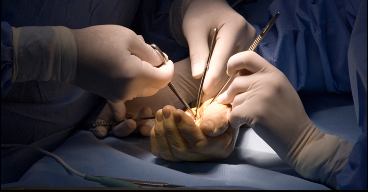 What Are Your Alternatives to Carpal Tunnel Surgery?