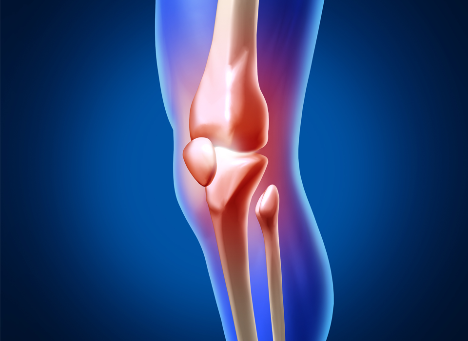 What If your knee pain was really caused by your ankle?