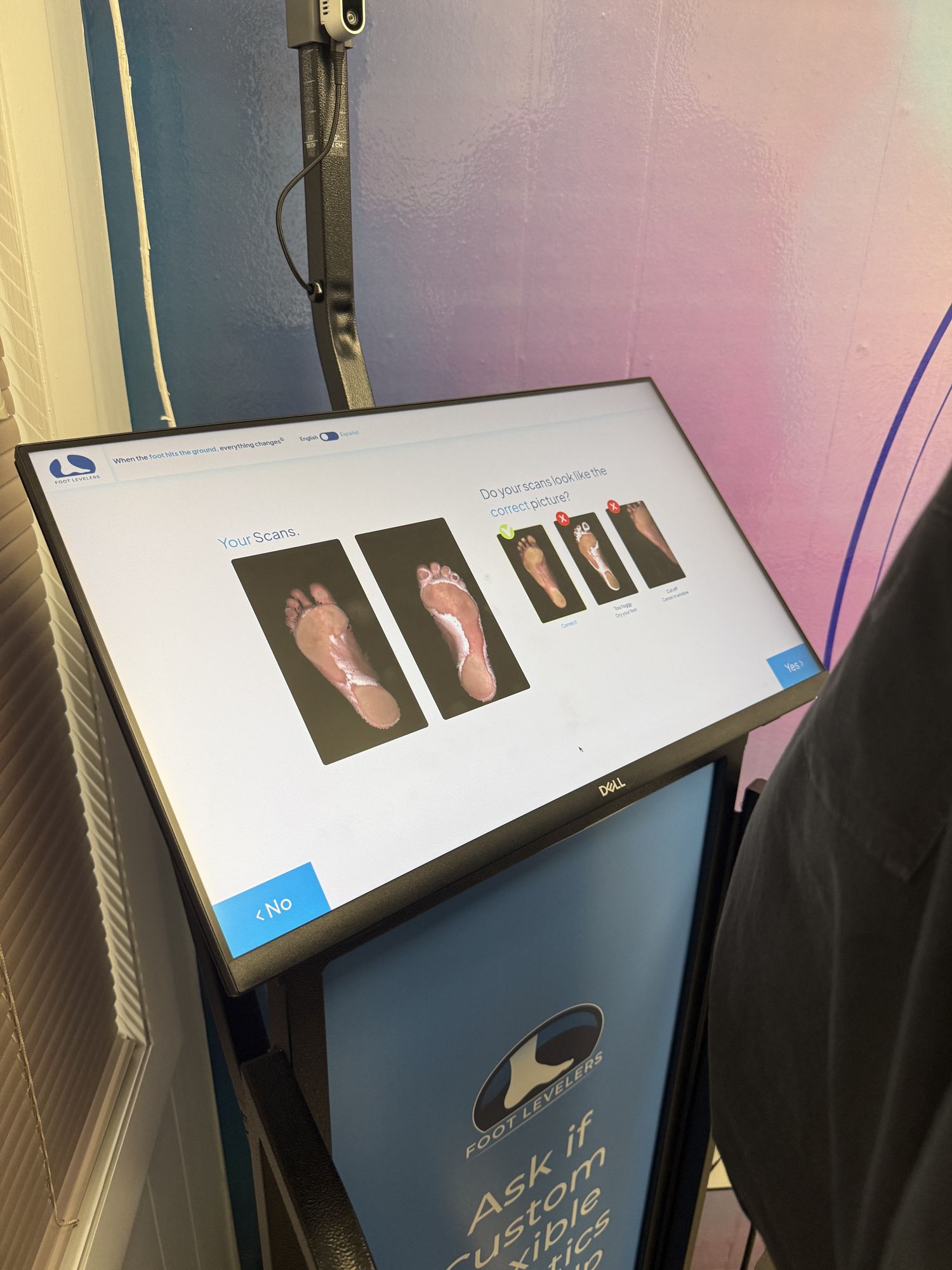 A patient's 3D foot scans shown on the Foot Levelers scanner during a custom-orthotics evaluation