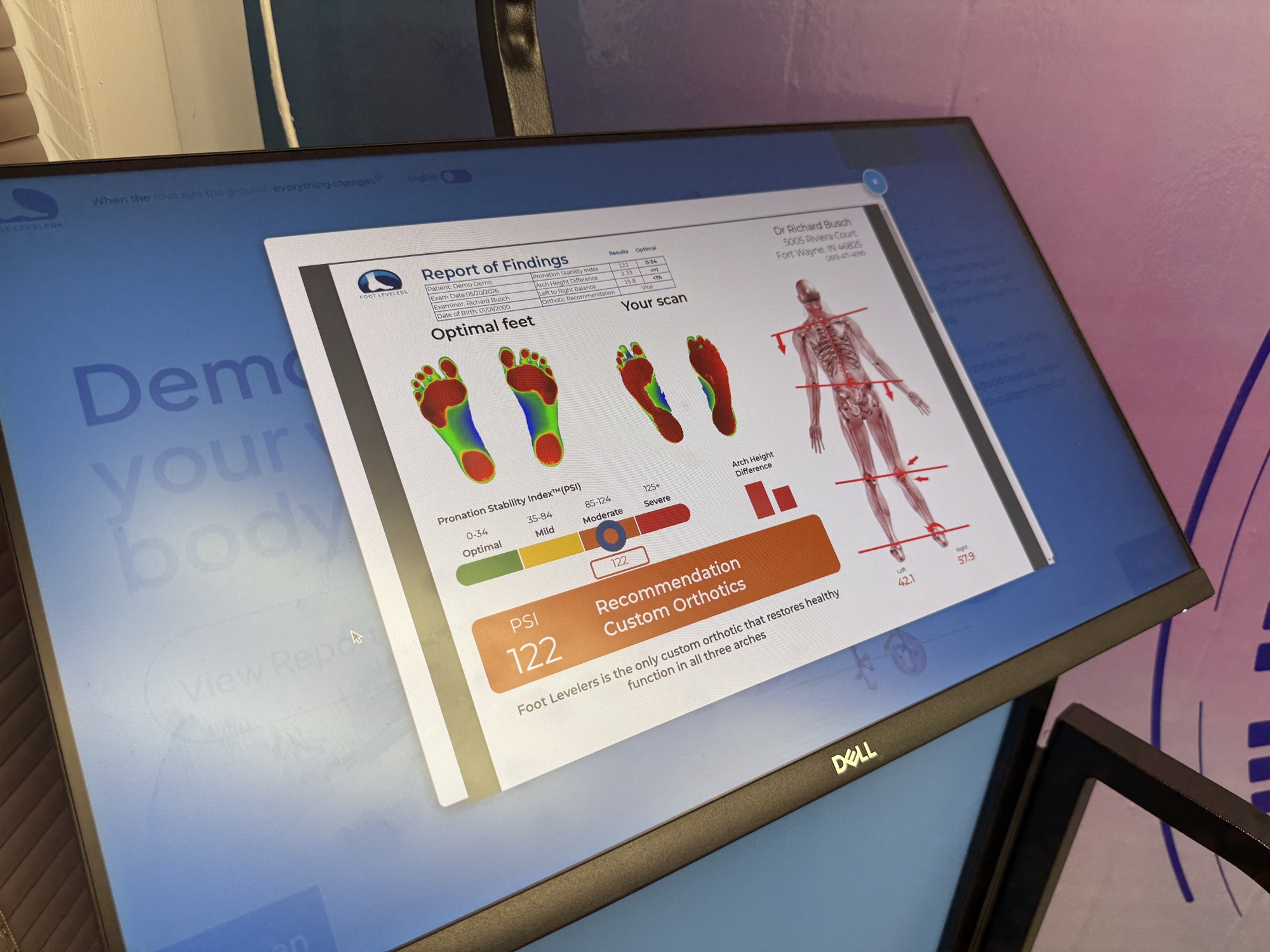 A patient's Foot Levelers Report of Findings on screen — comparing optimal foot-pressure maps with the patient's own scan and recommending custom orthotics