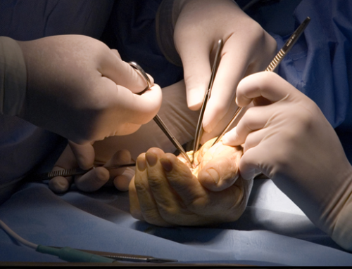 What Are Your Alternatives to Carpal Tunnel Surgery?